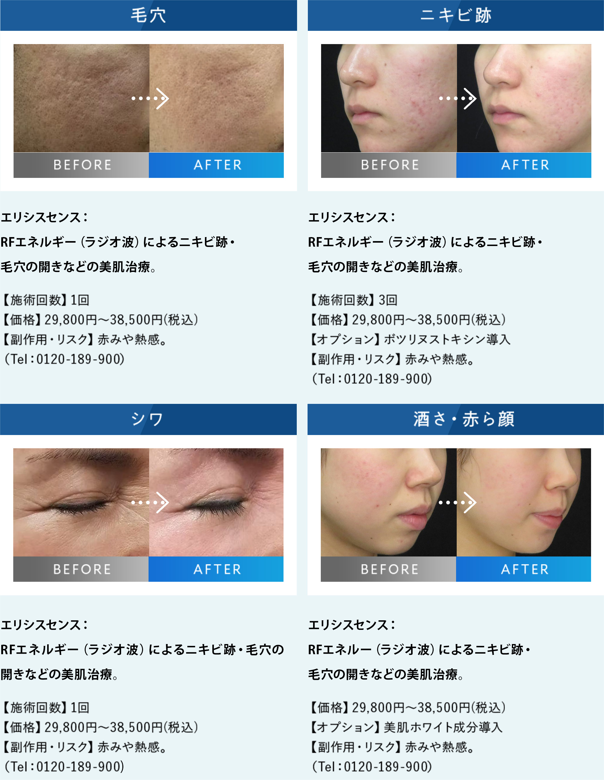 case photo あなたのお悩みにしっかりコミット！ エリシスセンスの症例写真