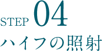 STEP04 ハイフの照射