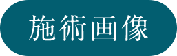 施術画像