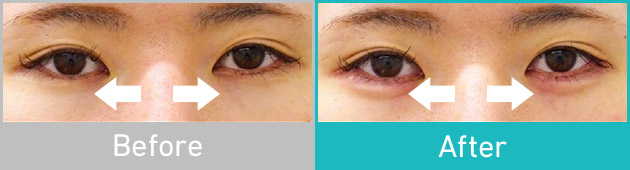Before After