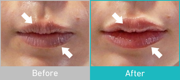 Before After
