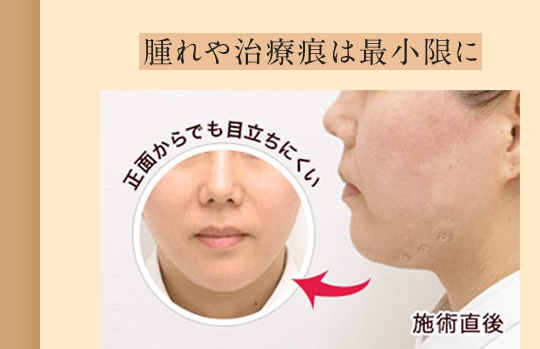 腫れや治療痕は最小限に