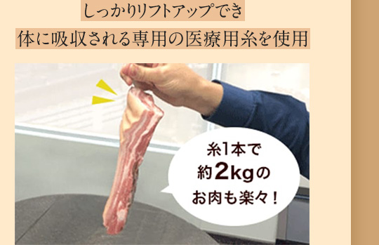 しっかりリフトアップでき体に吸収される専用の医療用糸を使用