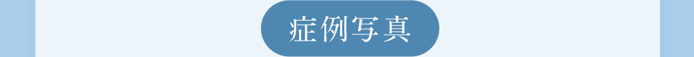 症例写真