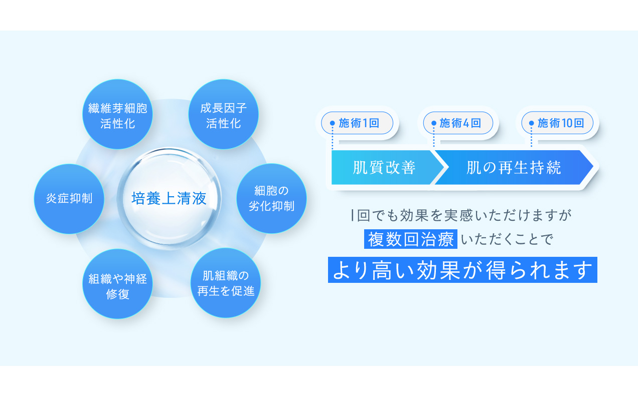 1回でも効果を実感いただけますが複数回治療いただくことでより高い効果が得られます