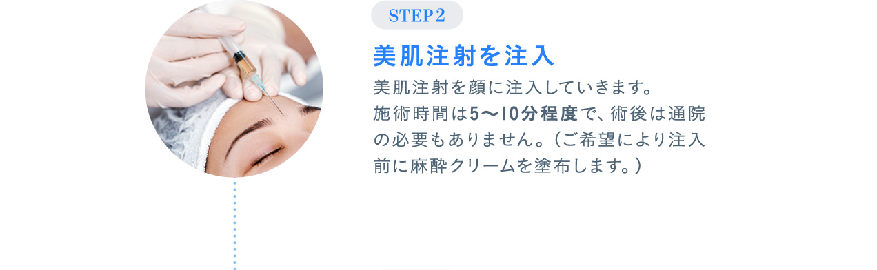 STEP02 美肌注射を注入 美肌注射を顔に注入していきます。施術時間は5～10分程度で、術後は通院の必要もありません。（ご希望により注入前に麻酔クリームを塗布します。）