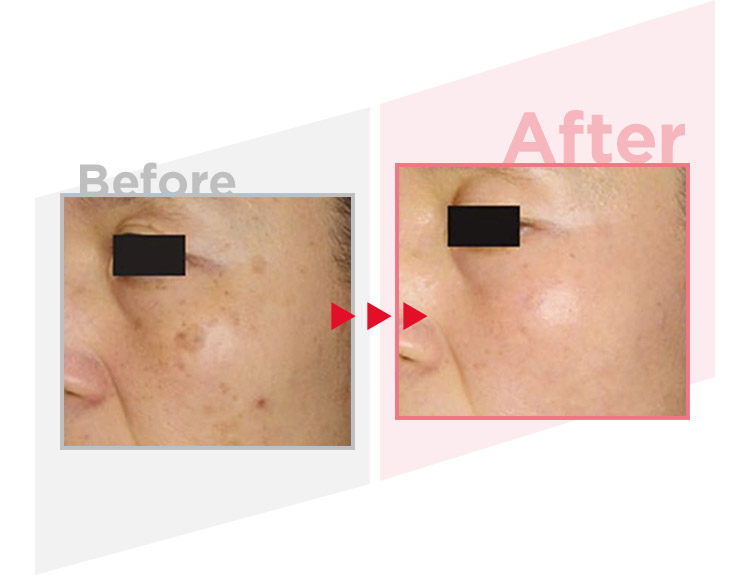 Before_After