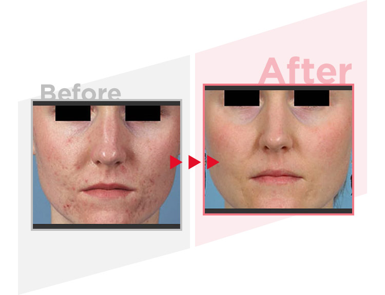 Before_After