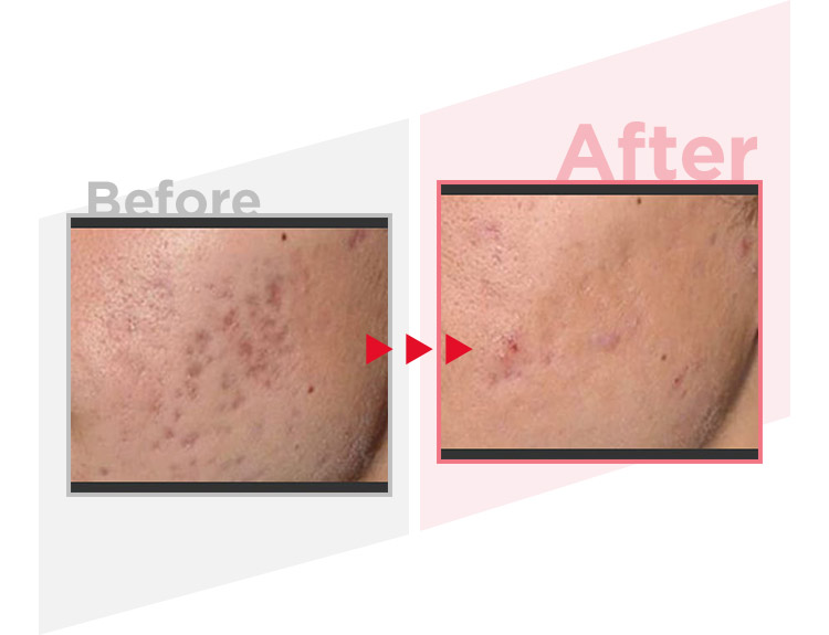 Before_After