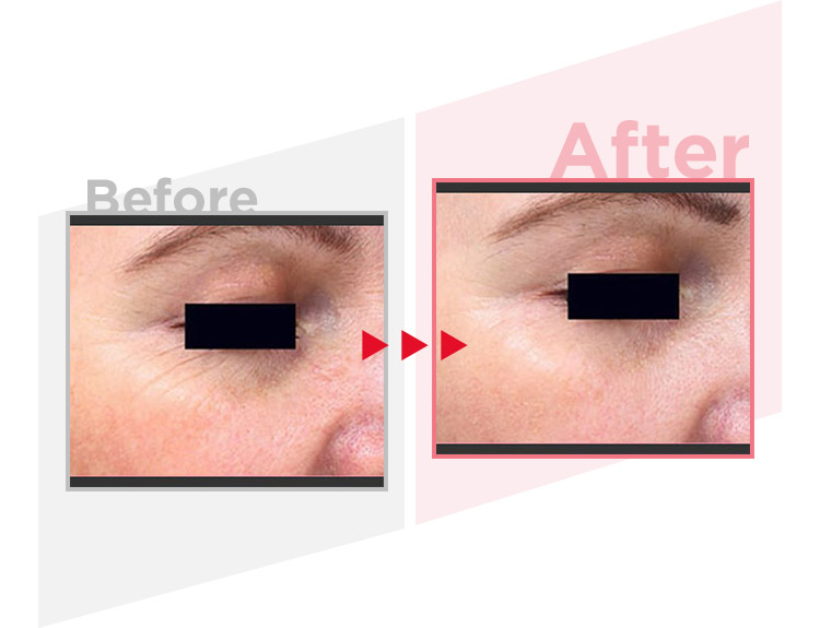 Before_After