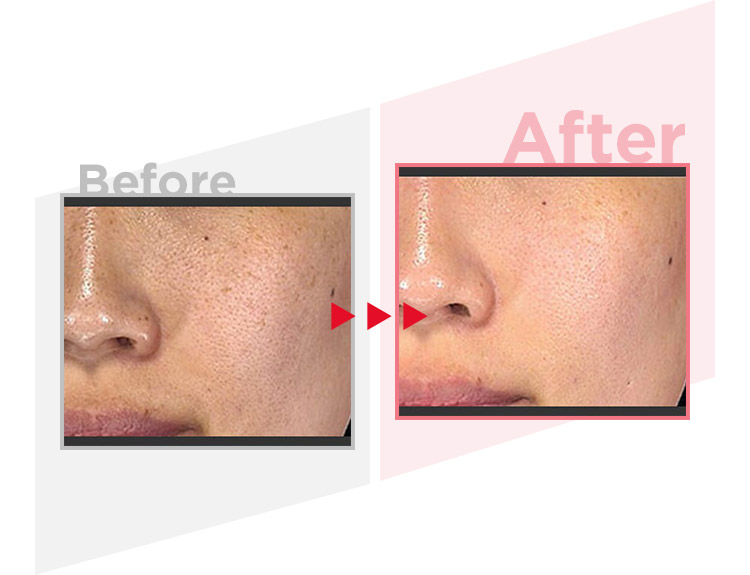 Before_After