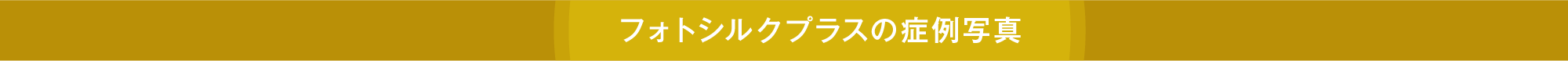 ピコトーニング症例写真
