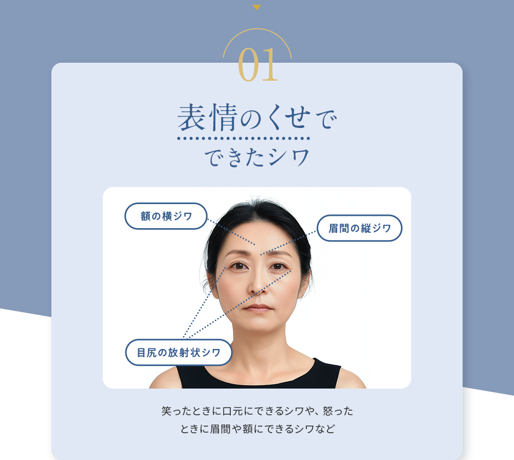 01 表情のくせでできたシワ