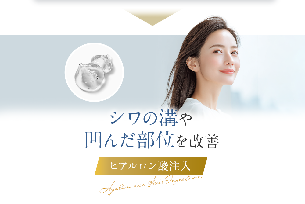 シワの溝や凹んだ部位を改善 ヒアルロン酸注入
