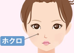 ホクロを取りたい！