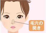 毛穴の開きを治したい！