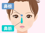 鼻筋を整えて鼻を高くしたい