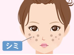 シミを消したい！