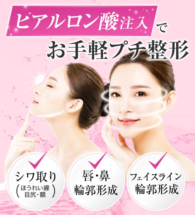 ヒアルロン酸注入でお手軽プチ整形