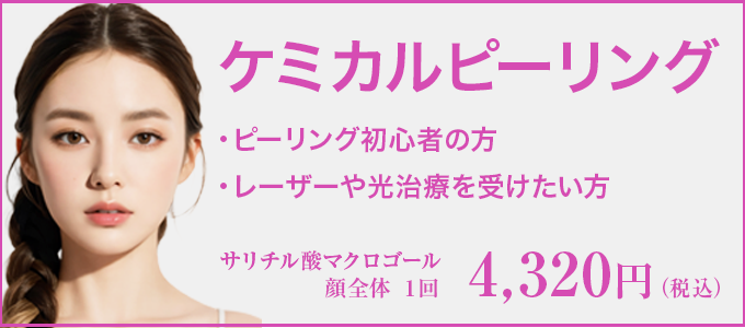 ケミカルピーリング