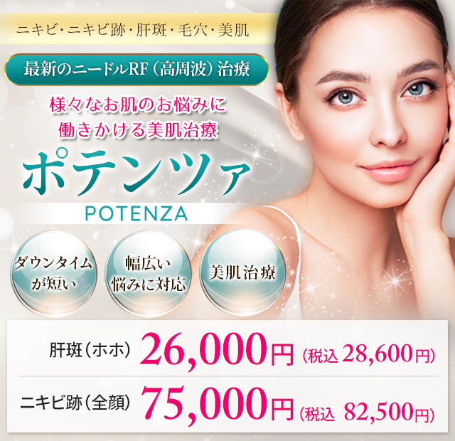 『ポテンツァ』ニキビ跡・毛穴・小ジワ・肝斑を改善してキレイな美肌へ