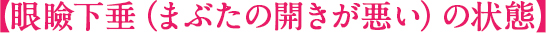 眼瞼下垂（まぶたの開きが悪い）の状態
