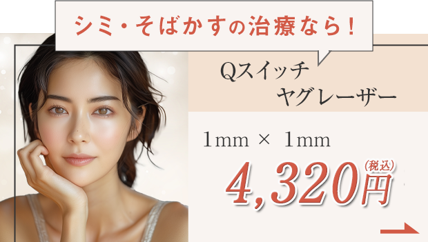 Qスイッチヤグレーザー