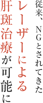 従来、NGとされてきたレーザーによる肝斑治療が可能に