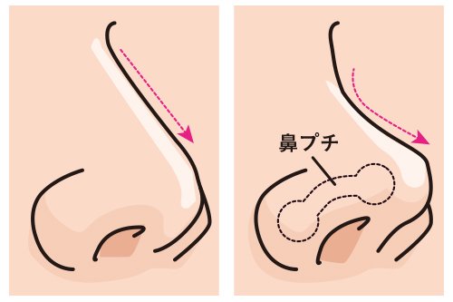 メイク？セルフケア？お鼻の悩みの解決方法とは