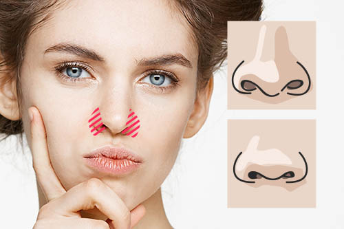 小鼻を形作る「鼻翼（びよく）」