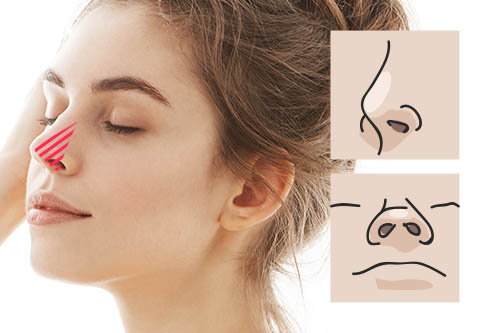 鼻の高さ・形に影響する「鼻柱（はなばしら）」と「鼻中隔軟骨（びちゅうかくなんこつ）」