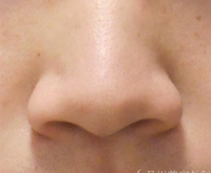 鼻先の幅が広いタイプ