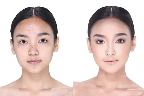 「忘れ鼻」になりたい！どうすれば？