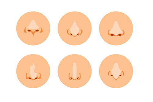 小鼻縮小術を受ける上での注意点