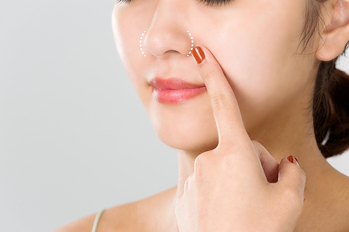 小鼻を小さくする方法とは？美容外科での治療法を解説