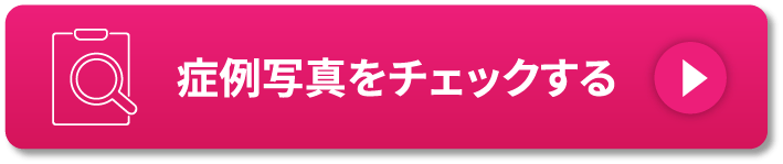 症例写真をチェックする