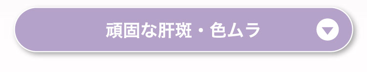 頑固な​肝斑・色ムラ