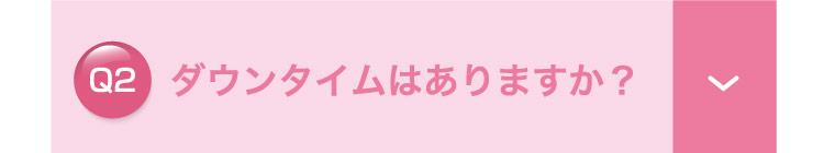 ダウンタイムは​ありますか？
