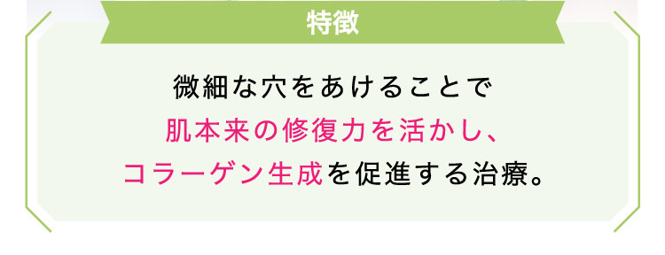 【特徴】微細な穴を​あける​ことで​肌本来の​修復力を​活かし、コラーゲン生成を​促進する​治療。​​