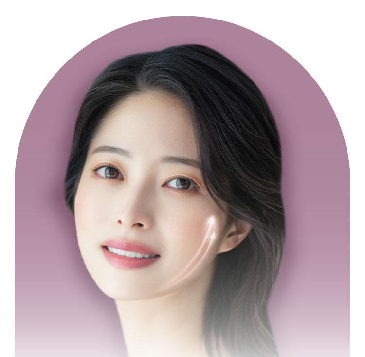 美肌糸リフト​