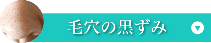 毛穴の黒ずみ