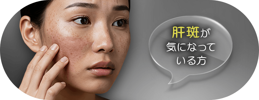 肝斑が気になっている方