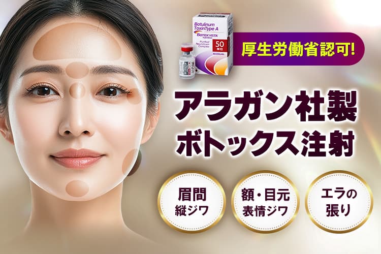 厚生労働省認可！アラガン社製ボトックス注射 眉間縦ジワ/額・目元表情ジワ/エラの張り