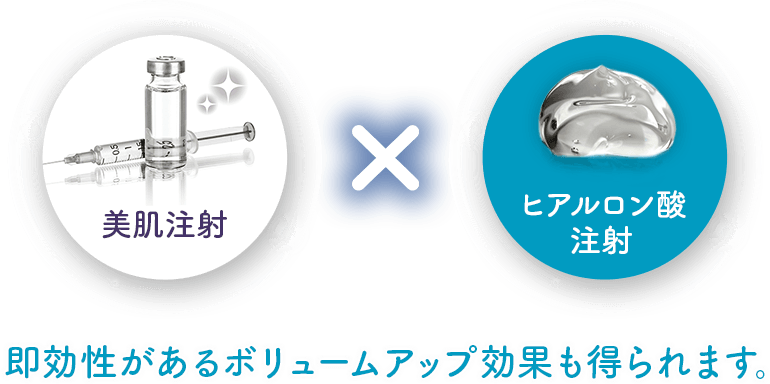 美肌注射×ヒアルロン酸注射 即効性があるボリュームアップ効果も得られます。