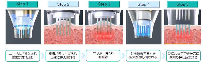 ポテンツァとは