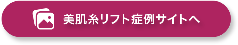 美肌糸リフト症例サイトへ