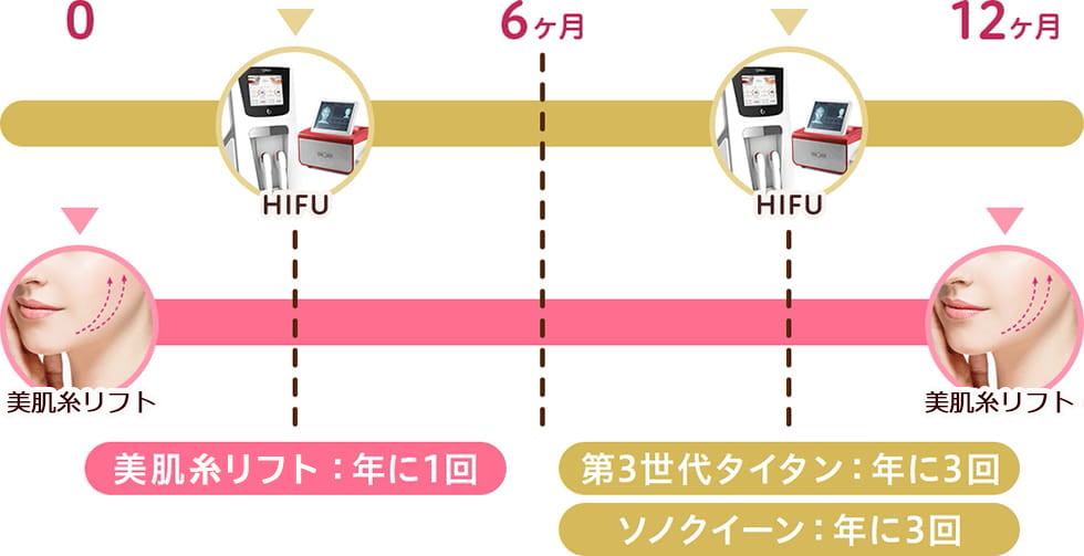 効果的に若さを保つには？美肌糸リフト：年に1回 第3世代タイタン：年に3回 ソノクイーン：年に3回【画像】