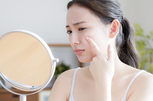 シミ取り後のダウンタイムはある？