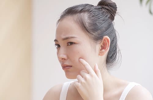 シミ取り後の肌トラブルを防ぐために気をつけたいこと