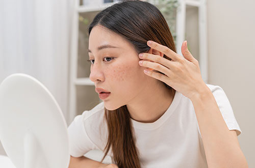 シミ取りレーザーができない人の理由とは？おすすめの代替治療法や治療を受けるときの注意点を解説